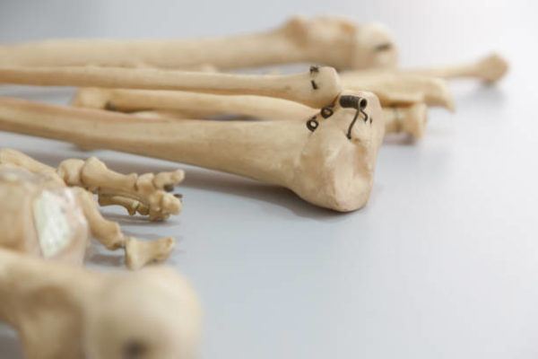 Roopkund el lago de los esqueletos historia